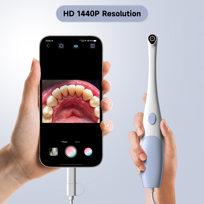Oral Endoscope Camera 1440P Ph - Photography Lighting Description ulasan dan harga
