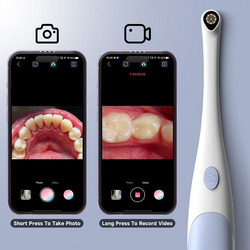 Oral Endoscope Camera 1440P Ph - Photography Lighting Description ulasan dan harga