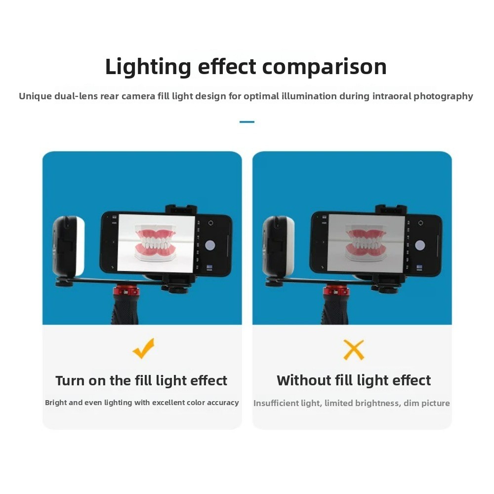Dental Photography Light, Blue - Photography Lighting Patterns ulasan dan harga
